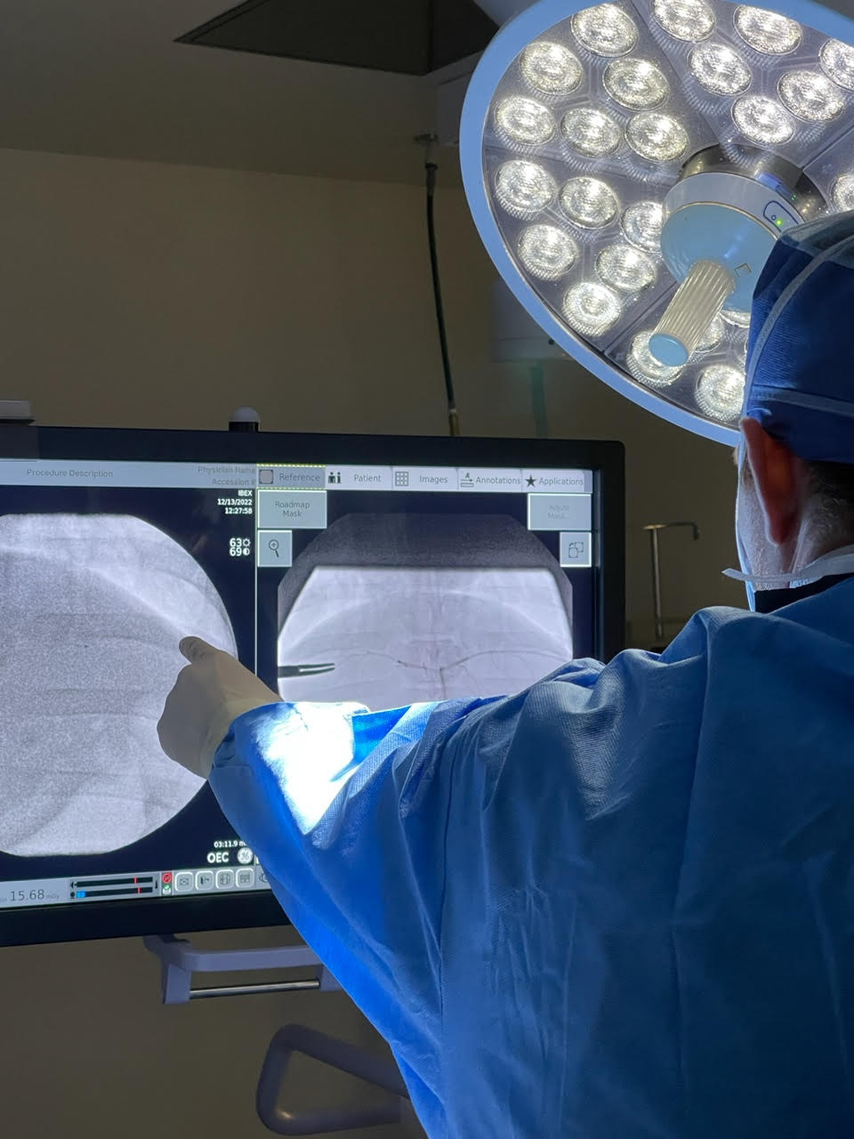 Minimally Invasive