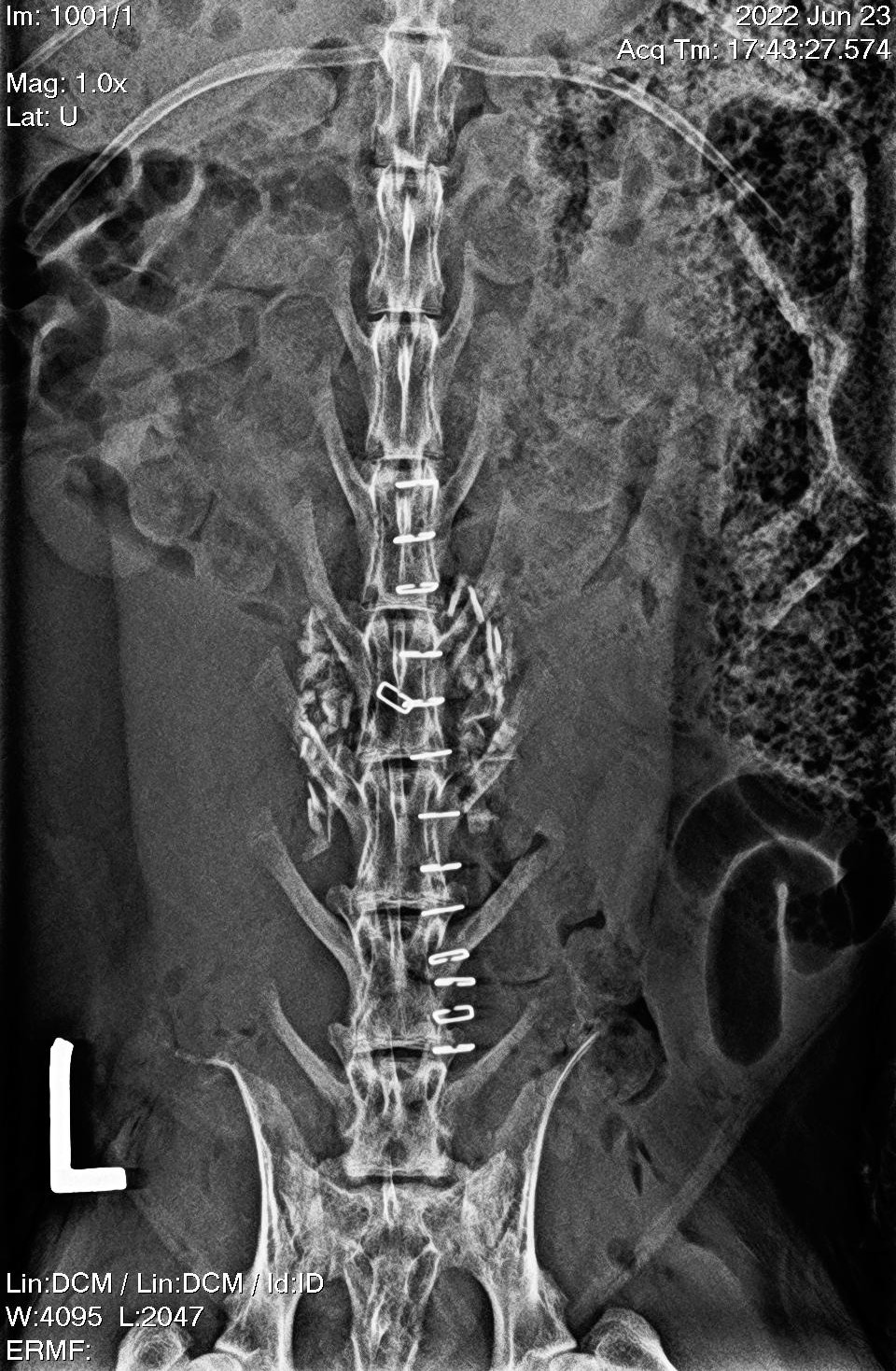 Osteoinductivity