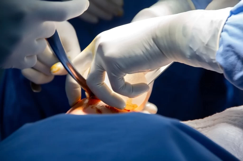 Wound Healing Studies